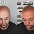 Gary Client befoe then after