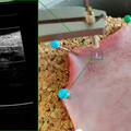 On the left the OCT image of a porcine bladder tissue at the laser line inside the green square. The OCT image clearly shows the different layers of t