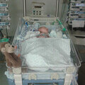 Finlay underwent two major heart surgeries at less than one month old