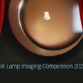 Haag-Streit Slit lamp imaging competition