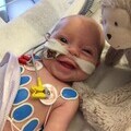 Molly underwent open heart surgery at just eight weeks old due to a large hole in her heart
