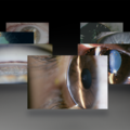 Haag-Streit Slit Lamp Imaging Competition