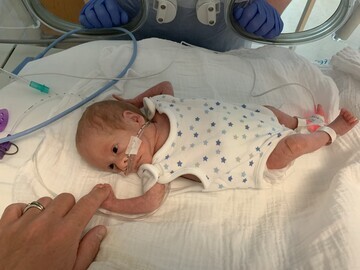 Premature Baby Austin