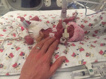 01. Eva was born weighing just 830g, pictured here in NICU