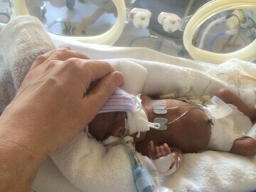 Premature baby Jack
