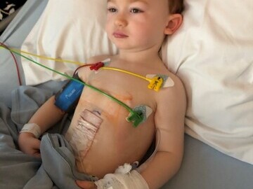 Three-year-old Albie Astirbadi who swallowed 6 magnets
