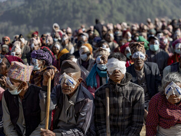 Hundreds of patients await the removal of their bandages after receiving surgery to cure their cataracts.