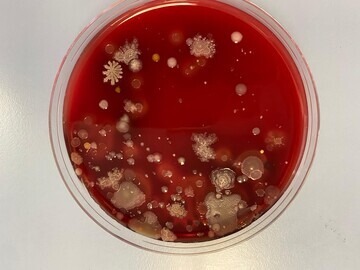 Agar plate of bacterial swab test