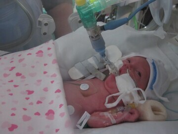 01. Amelia in her incubator.