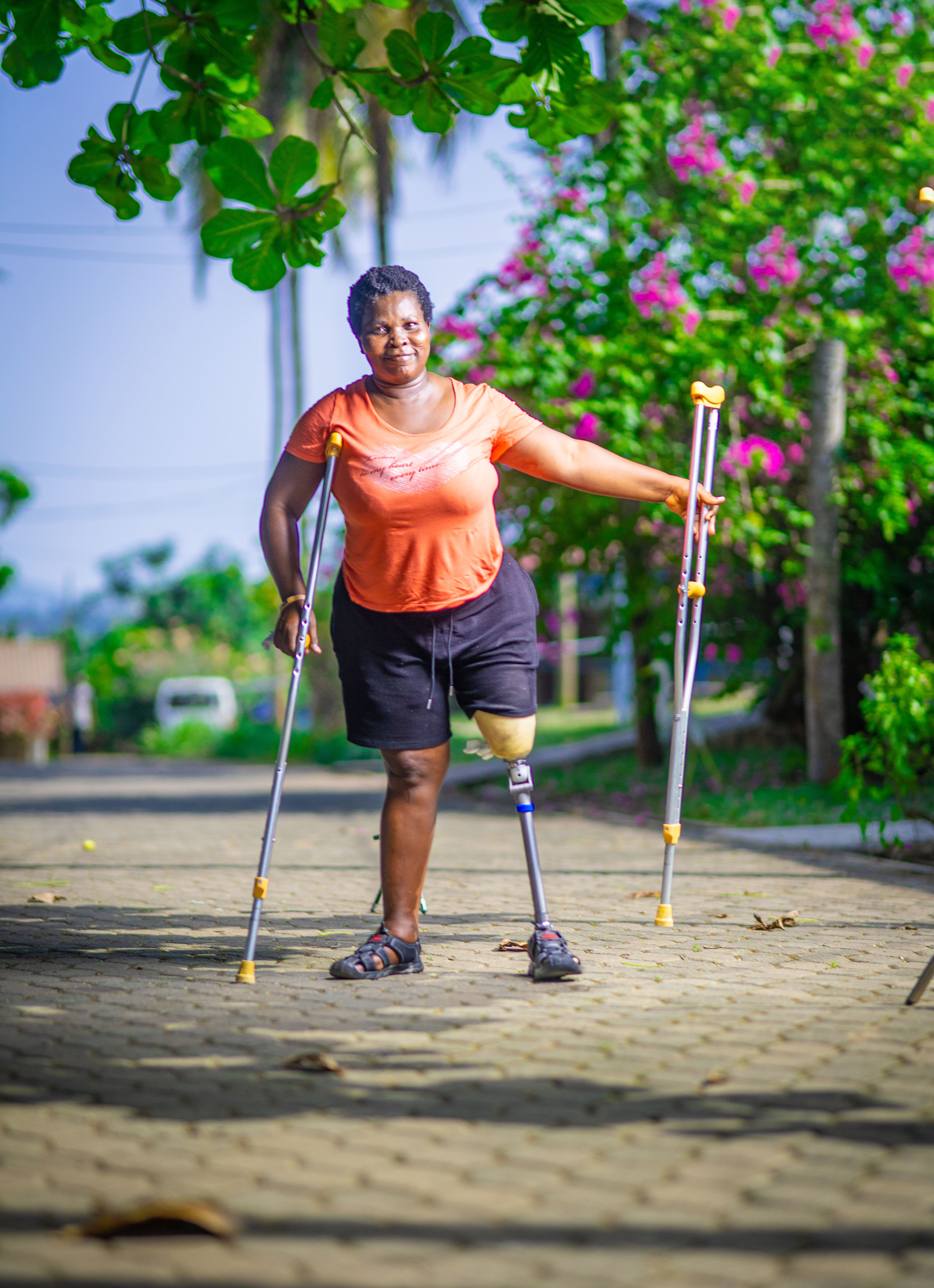 Catherine from Ghana. She lost her leg in a road traffic accident, and now has been fitted with a leg from STAND.